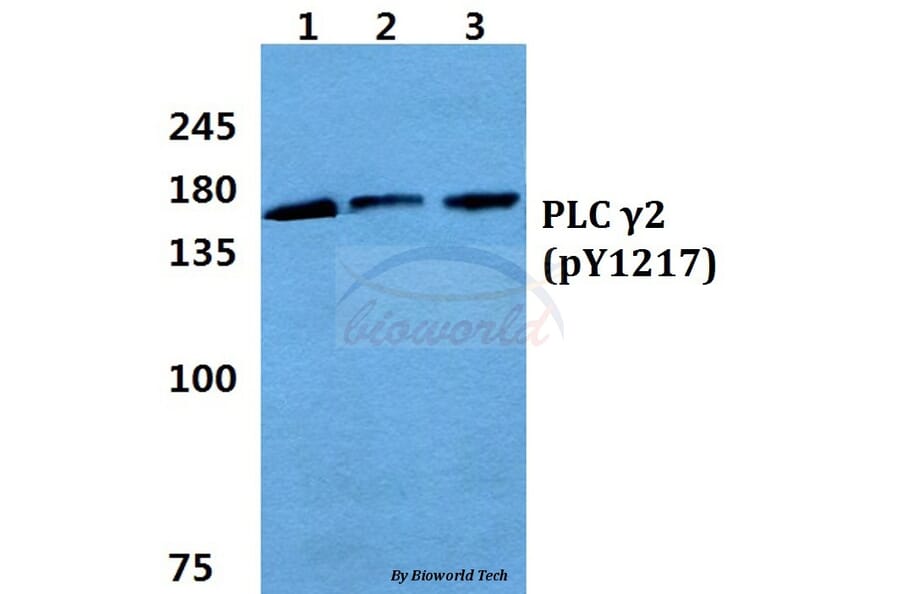 Anti-PLC γ2 (phospho-Y1217) Antibody from Bioworld Technology (BS4866) - Antibodies.com