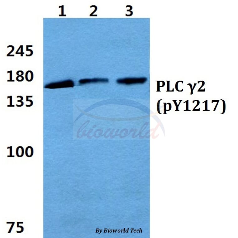 Anti-PLC γ2 (phospho-Y1217) Antibody from Bioworld Technology (BS4866) - Antibodies.com