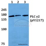 Anti-PLC γ2 (phospho-Y1217) Antibody from Bioworld Technology (BS4866) - Antibodies.com