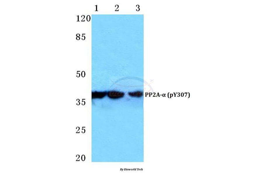 Anti-PP2A-α (phospho-Y307) Antibody from Bioworld Technology (BS4867) - Antibodies.com
