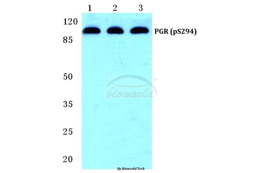 Anti-PR/PGR (phospho-S294) Antibody from Bioworld Technology (BS4868) - Antibodies.com