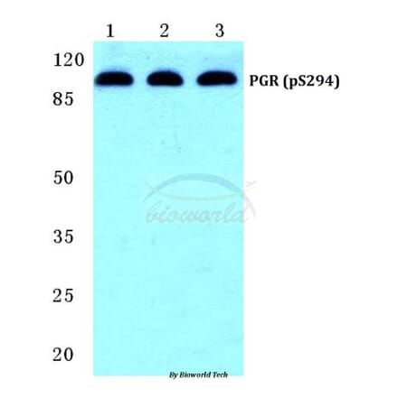 Anti-PR/PGR (phospho-S294) Antibody from Bioworld Technology (BS4868) - Antibodies.com