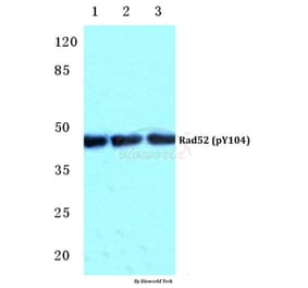 Anti-Rad52 (phospho-Y104) Antibody from Bioworld Technology (BS4869) - Antibodies.com