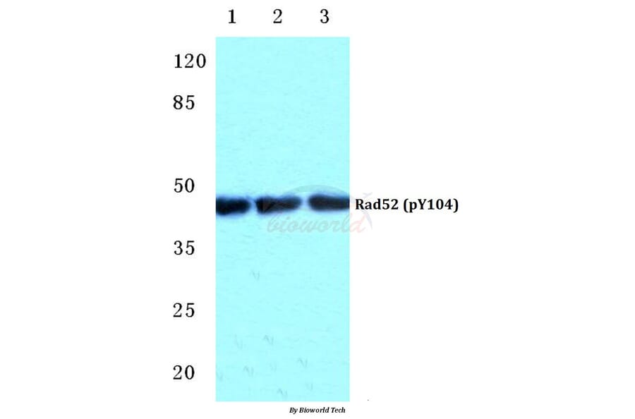 Anti-Rad52 (phospho-Y104) Antibody from Bioworld Technology (BS4869) - Antibodies.com