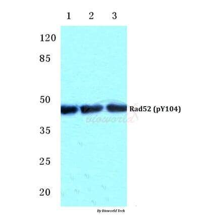 Anti-Rad52 (phospho-Y104) Antibody from Bioworld Technology (BS4869) - Antibodies.com