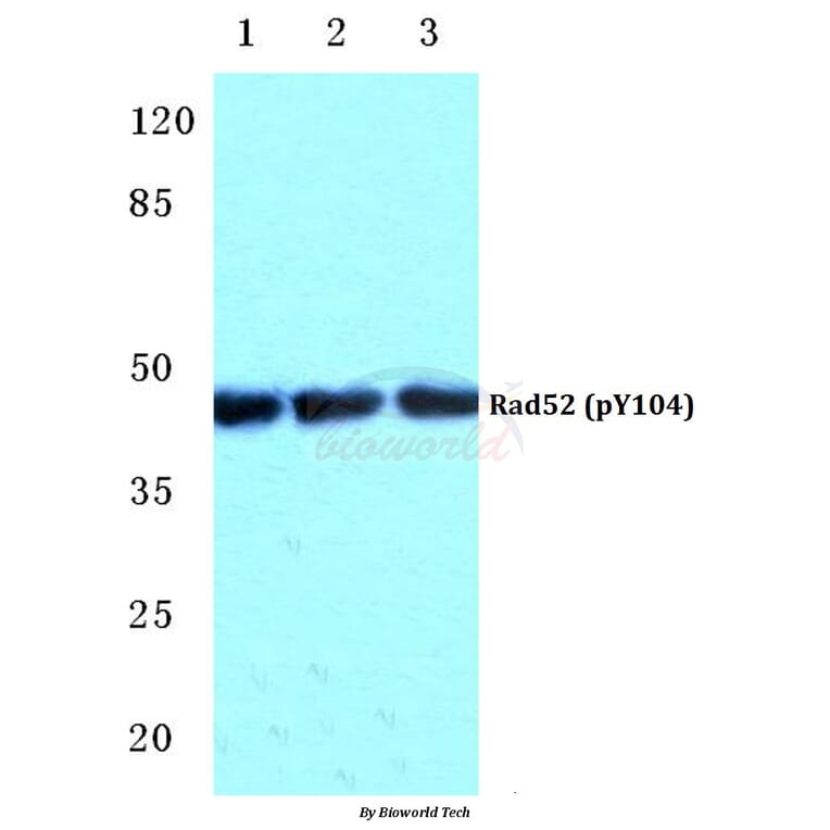 Anti-Rad52 (phospho-Y104) Antibody from Bioworld Technology (BS4869) - Antibodies.com