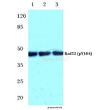 Anti-Rad52 (phospho-Y104) Antibody from Bioworld Technology (BS4869) - Antibodies.com
