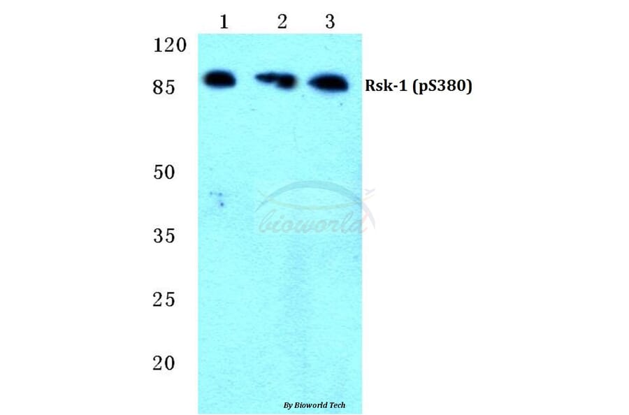 Anti-Rsk-1 (phospho-S380) Antibody from Bioworld Technology (BS4870) - Antibodies.com