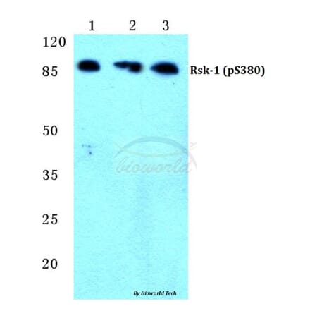 Anti-Rsk-1 (phospho-S380) Antibody from Bioworld Technology (BS4870) - Antibodies.com