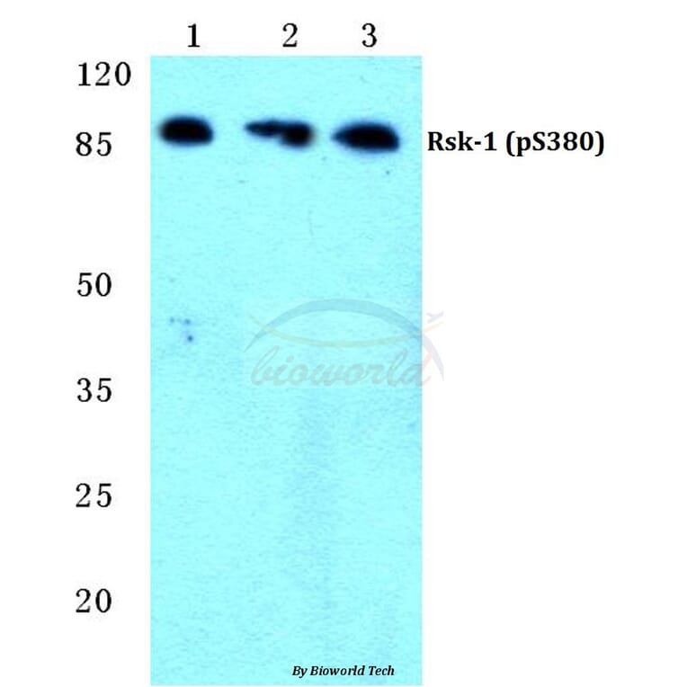 Anti-Rsk-1 (phospho-S380) Antibody from Bioworld Technology (BS4870) - Antibodies.com