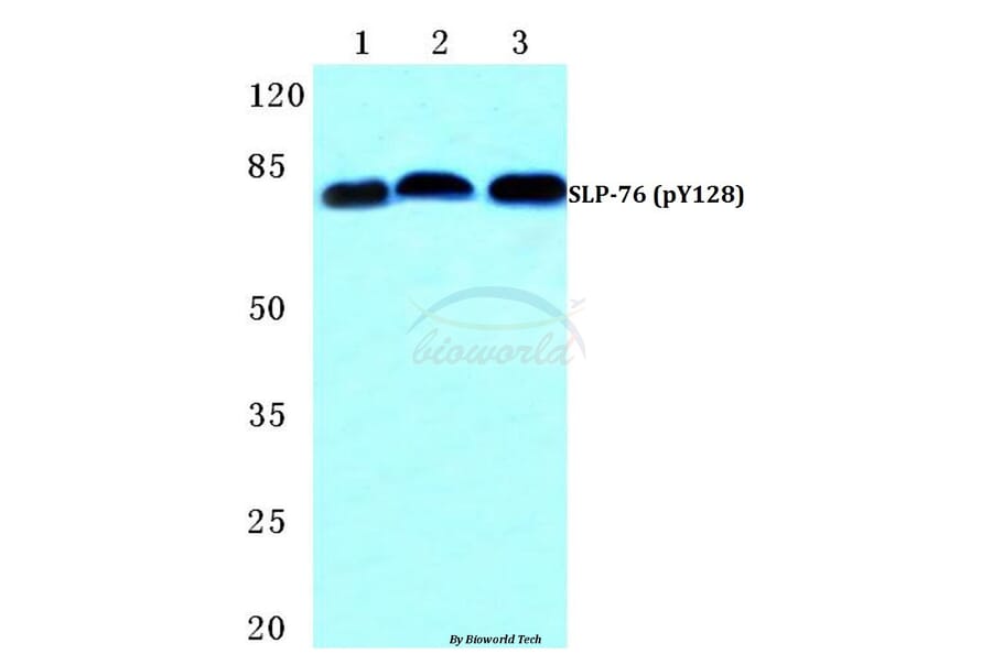 Anti-SLP-76 (phospho-Y128) Antibody from Bioworld Technology (BS4872) - Antibodies.com
