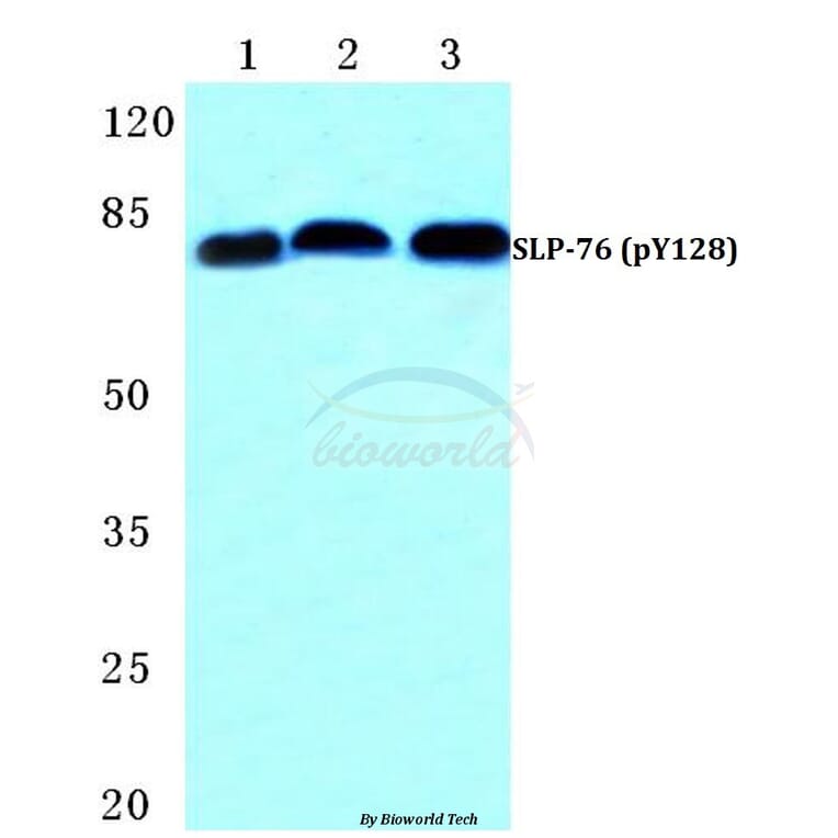 Anti-SLP-76 (phospho-Y128) Antibody from Bioworld Technology (BS4872) - Antibodies.com