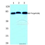 Anti-SLP-76 (phospho-Y128) Antibody from Bioworld Technology (BS4872) - Antibodies.com