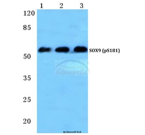 Anti-SOX9 (phospho-S181) Antibody from Bioworld Technology (BS4875) - Antibodies.com