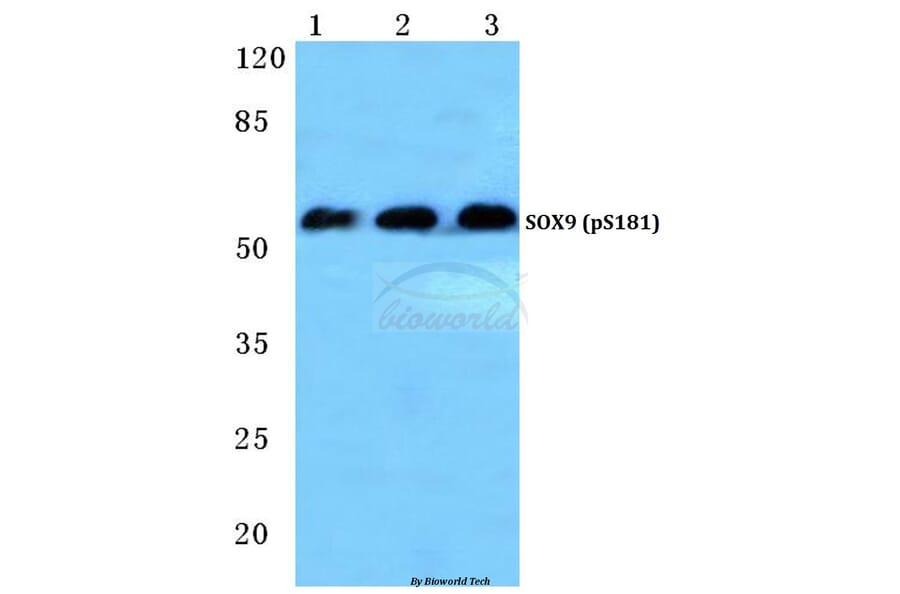 Anti-SOX9 (phospho-S181) Antibody from Bioworld Technology (BS4875) - Antibodies.com