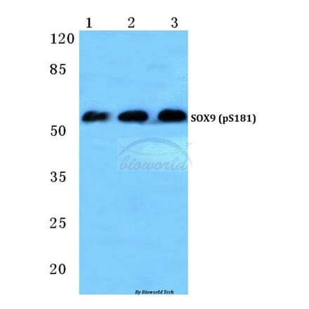 Anti-SOX9 (phospho-S181) Antibody from Bioworld Technology (BS4875) - Antibodies.com