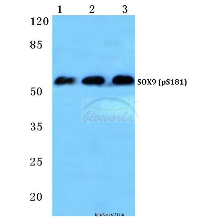 Anti-SOX9 (phospho-S181) Antibody from Bioworld Technology (BS4875) - Antibodies.com