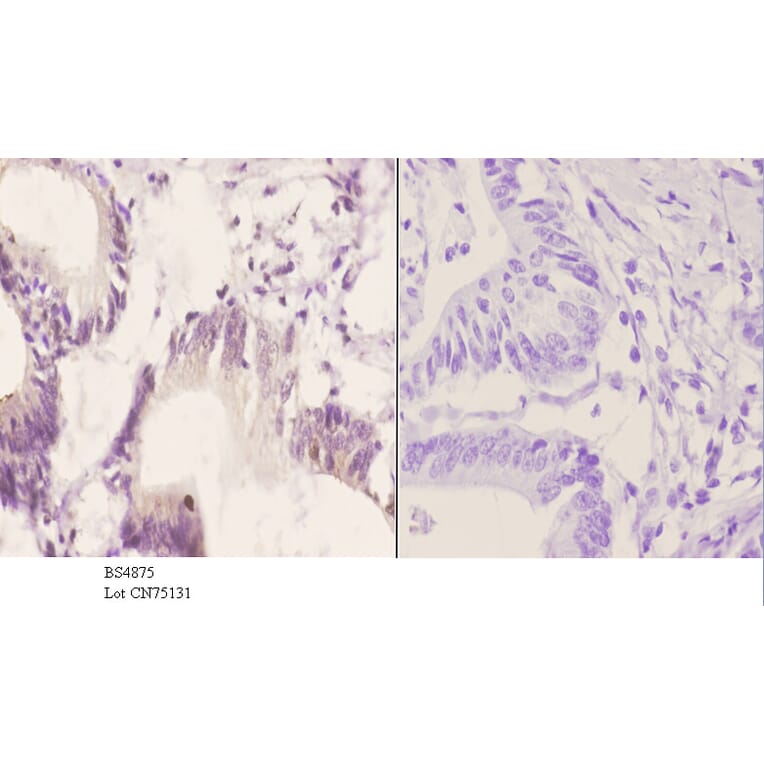 Anti-SOX9 (phospho-S181) Antibody from Bioworld Technology (BS4875) - Antibodies.com