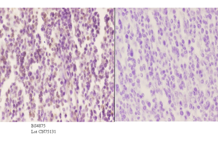 Anti-SOX9 (phospho-S181) Antibody from Bioworld Technology (BS4875) - Antibodies.com