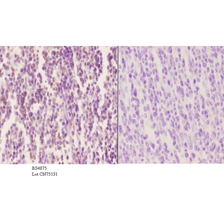 Anti-SOX9 (phospho-S181) Antibody from Bioworld Technology (BS4875) - Antibodies.com
