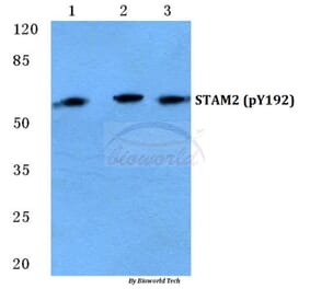 Anti-STAM2 (phospho-Y192) Antibody from Bioworld Technology (BS4876) - Antibodies.com