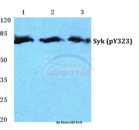 Anti-Syk (phospho-Y323) Antibody from Bioworld Technology (BS4878) - Antibodies.com