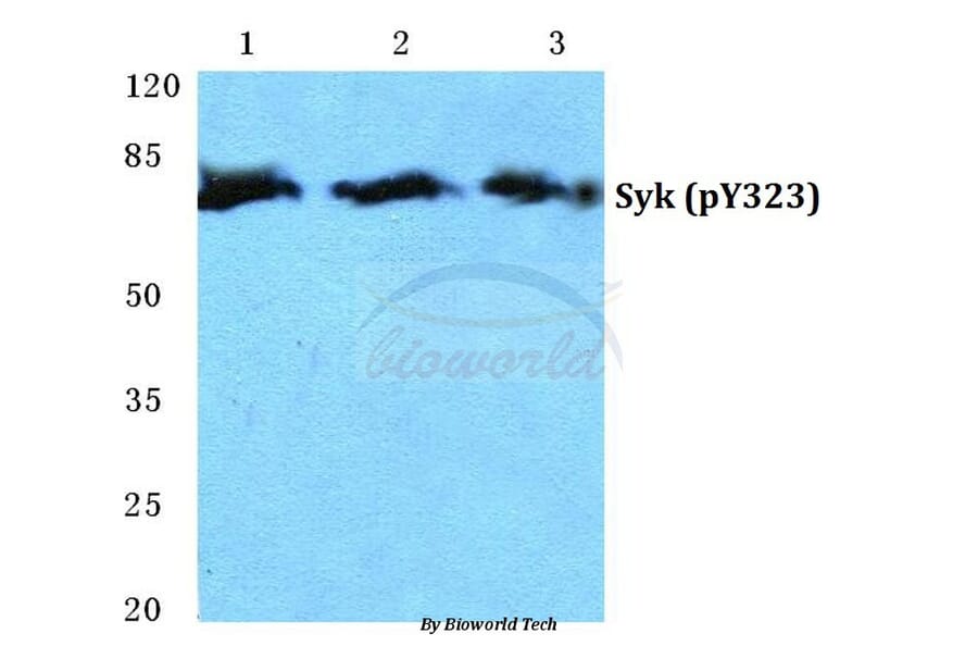 Anti-Syk (phospho-Y323) Antibody from Bioworld Technology (BS4878) - Antibodies.com