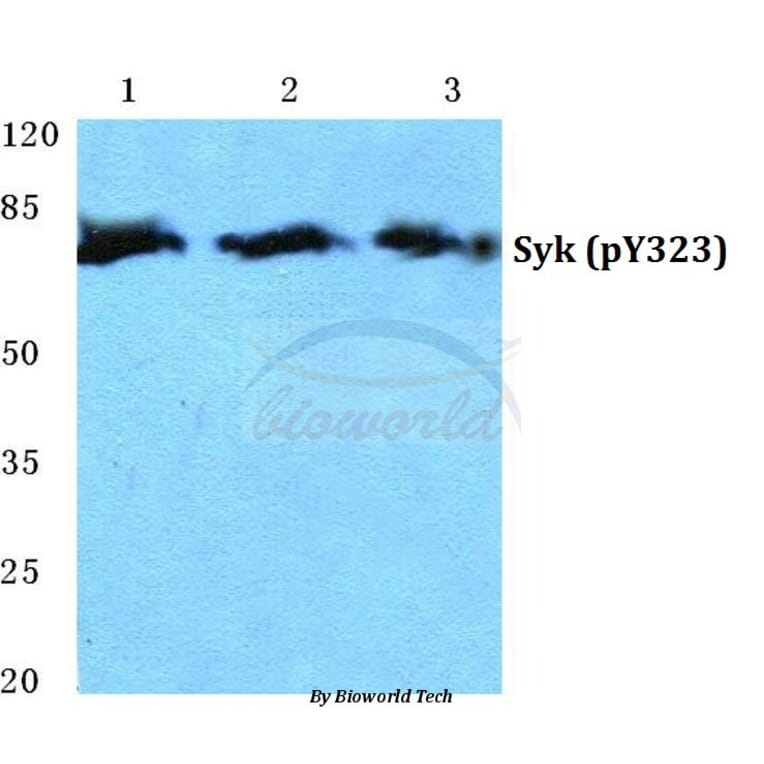 Anti-Syk (phospho-Y323) Antibody from Bioworld Technology (BS4878) - Antibodies.com