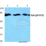 Anti-Syk (phospho-Y323) Antibody from Bioworld Technology (BS4878) - Antibodies.com