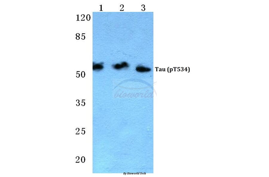 Anti-Tau (phospho-T534) Antibody from Bioworld Technology (BS4880) - Antibodies.com