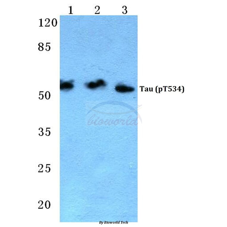 Anti-Tau (phospho-T534) Antibody from Bioworld Technology (BS4880) - Antibodies.com
