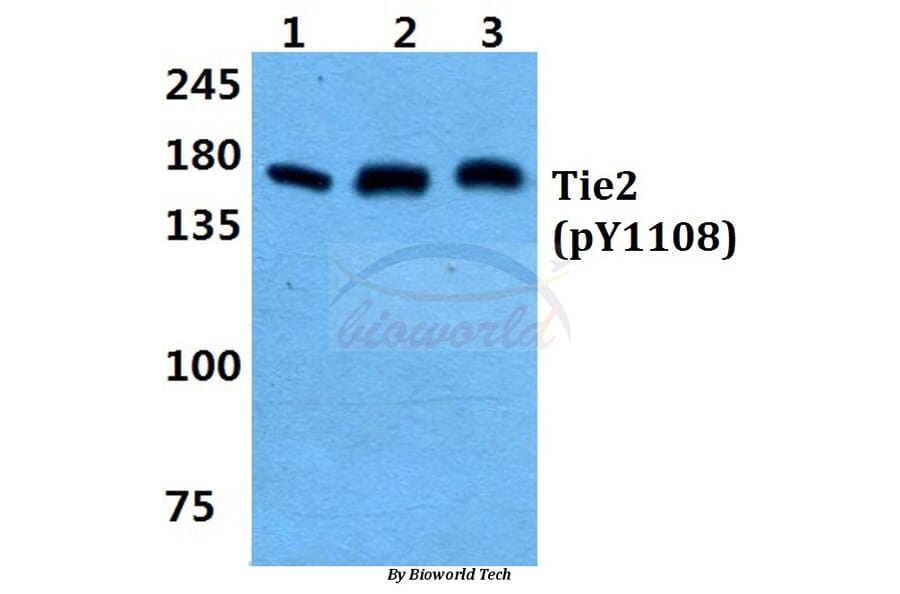 Anti-Tie-2 (phospho-Y1108) Antibody from Bioworld Technology (BS4881) - Antibodies.com