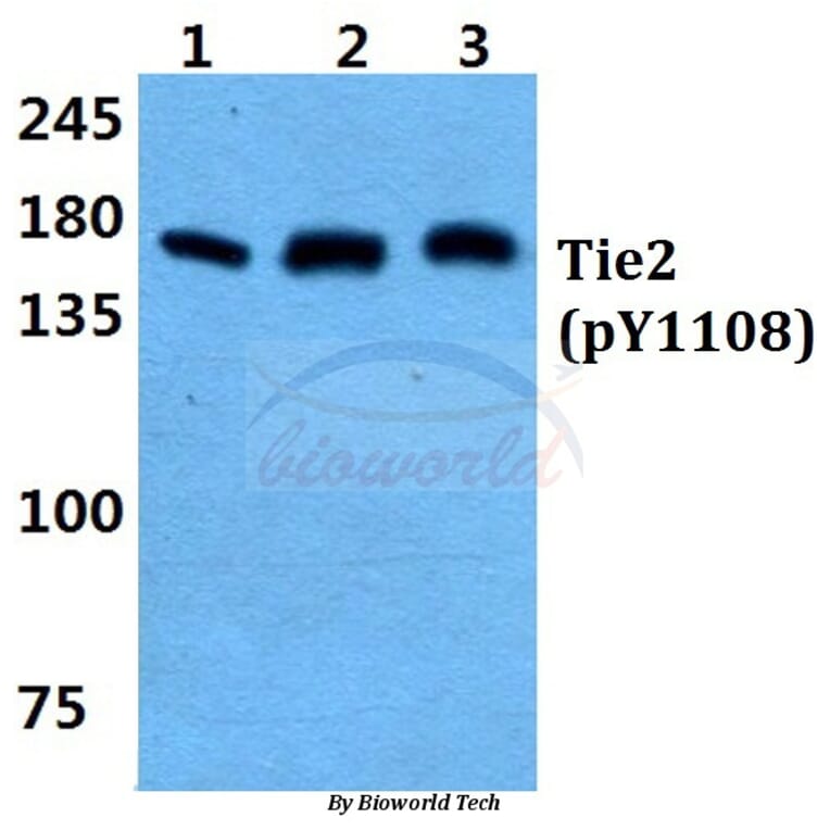 Anti-Tie-2 (phospho-Y1108) Antibody from Bioworld Technology (BS4881) - Antibodies.com
