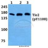 Anti-Tie-2 (phospho-Y1108) Antibody from Bioworld Technology (BS4881) - Antibodies.com