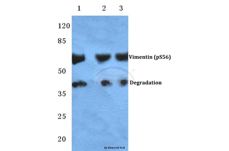Anti-Vimentin (phospho-S56) Antibody from Bioworld Technology (BS4883) - Antibodies.com
