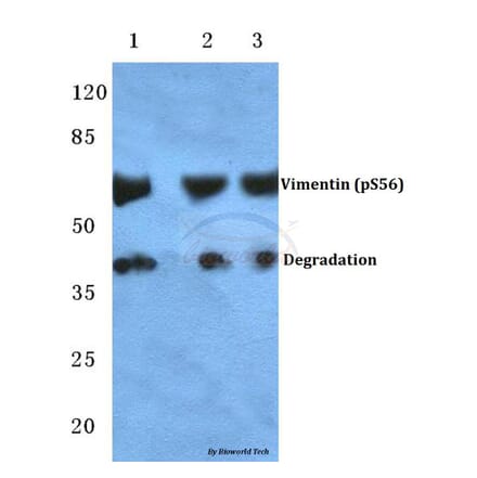 Anti-Vimentin (phospho-S56) Antibody from Bioworld Technology (BS4883) - Antibodies.com