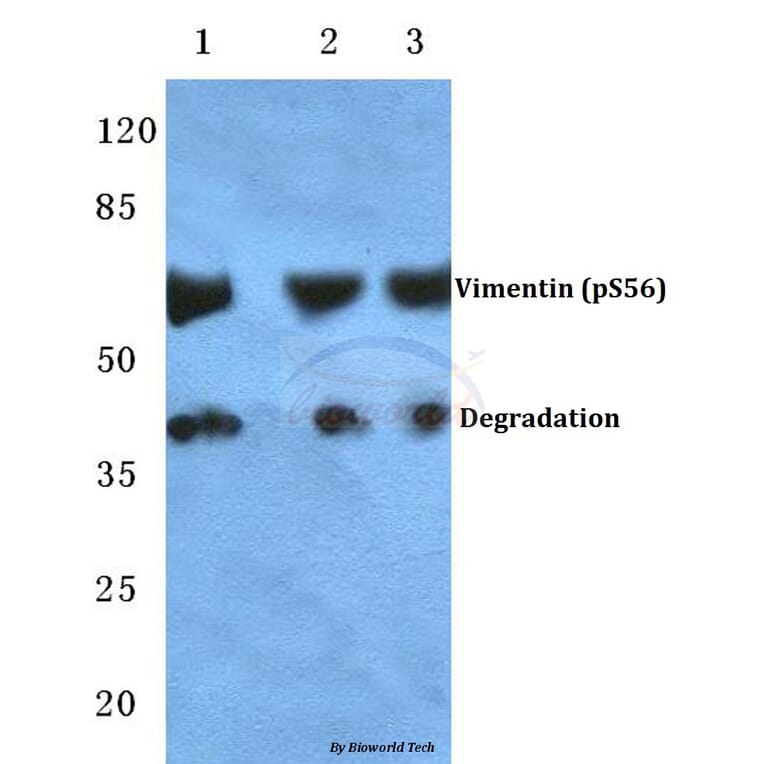 Anti-Vimentin (phospho-S56) Antibody from Bioworld Technology (BS4883) - Antibodies.com