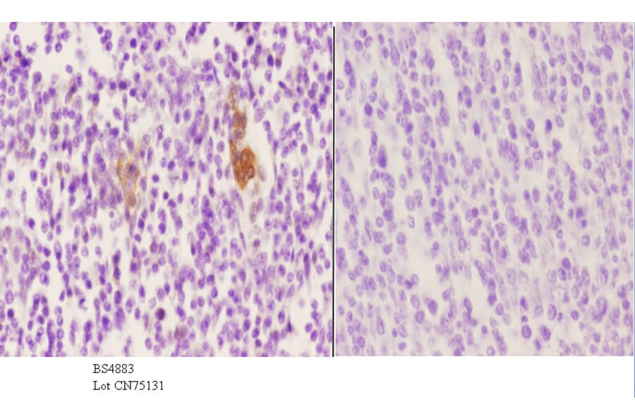 Anti-Vimentin (phospho-S56) Antibody from Bioworld Technology (BS4883) - Antibodies.com