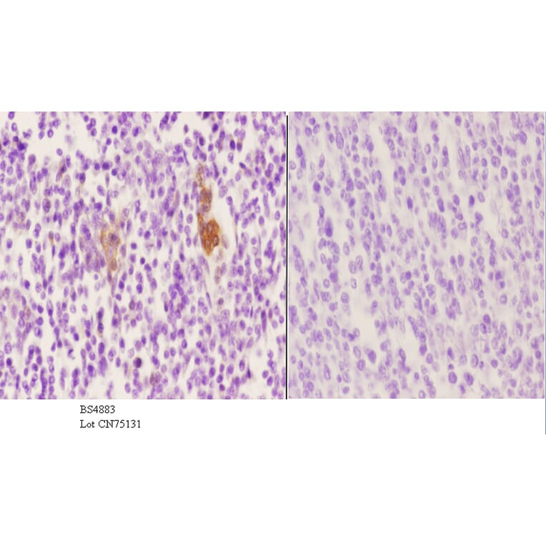Anti-Vimentin (phospho-S56) Antibody from Bioworld Technology (BS4883) - Antibodies.com