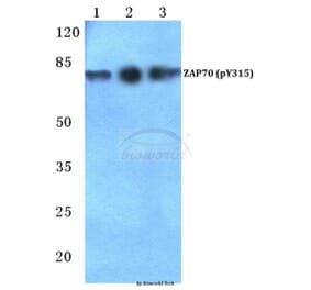 Anti-ZAP70 (phospho-Y315) Antibody from Bioworld Technology (BS4884) - Antibodies.com