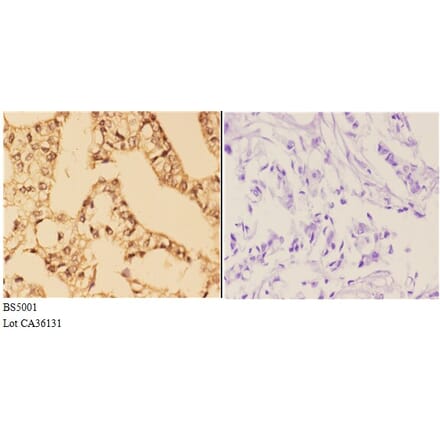 Anti-4E-BP1 (phospho-S65) Antibody from Bioworld Technology (BS5001) - Antibodies.com