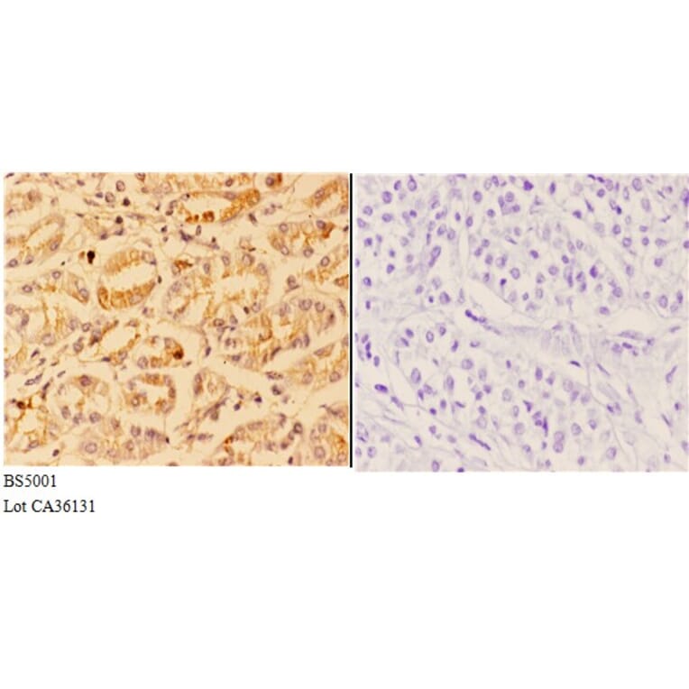 Anti-4E-BP1 (phospho-S65) Antibody from Bioworld Technology (BS5001) - Antibodies.com