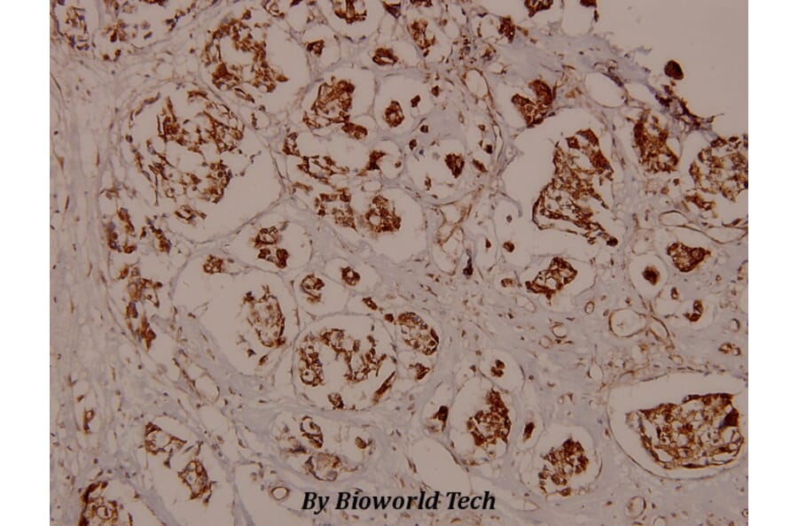 Anti-CaMKIIα (phospho-T286) Antibody from Bioworld Technology (BS5009) - Antibodies.com