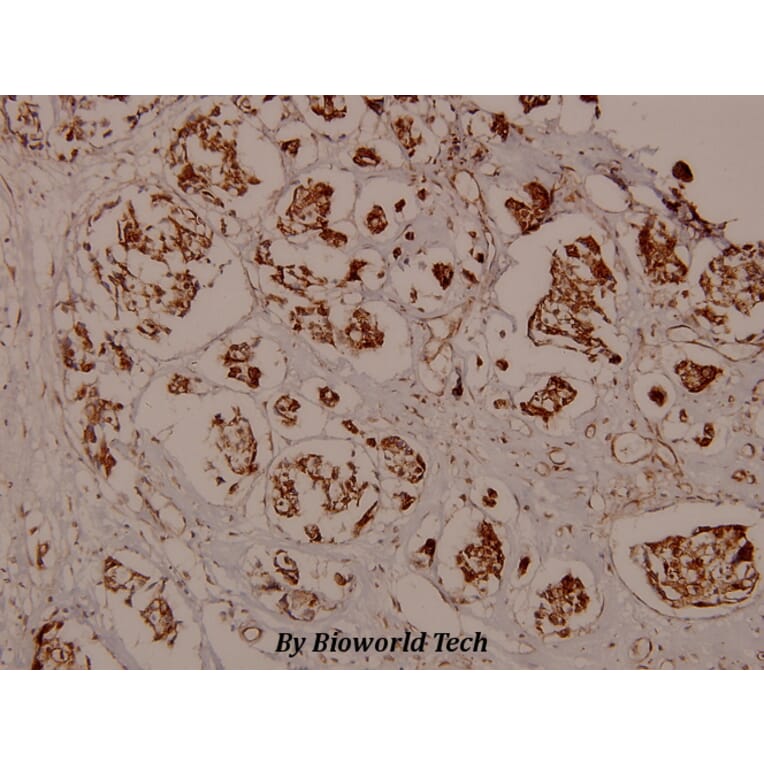 Anti-CaMKIIα (phospho-T286) Antibody from Bioworld Technology (BS5009) - Antibodies.com
