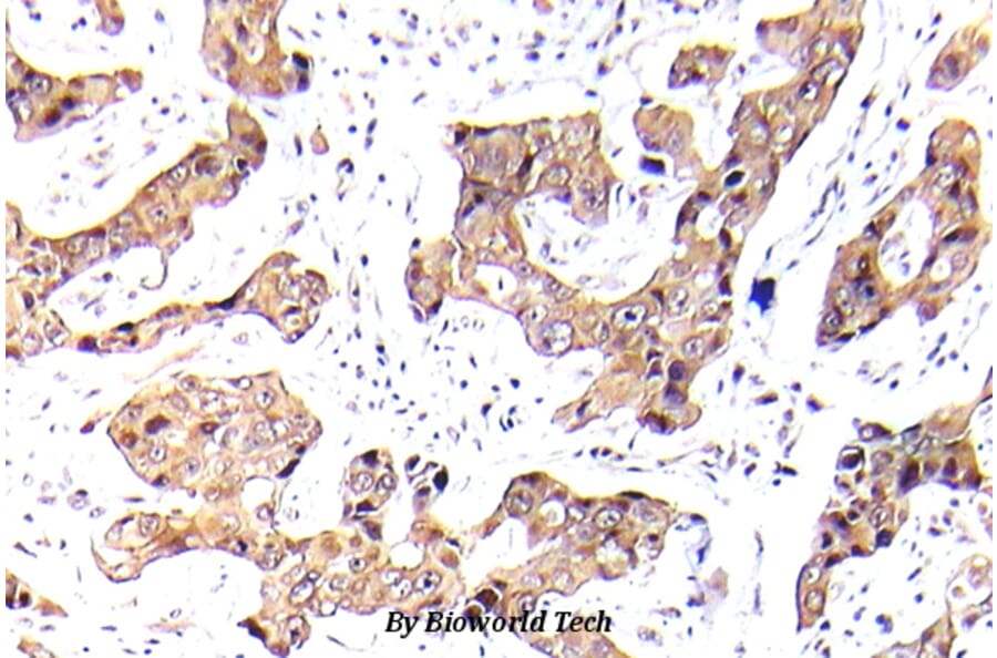 Anti-FKHR/FOXO1A (phospho-S256) Antibody from Bioworld Technology (BS5017) - Antibodies.com