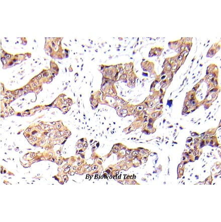Anti-FKHR/FOXO1A (phospho-S256) Antibody from Bioworld Technology (BS5017) - Antibodies.com