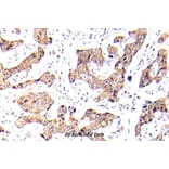 Anti-FKHR/FOXO1A (phospho-S256) Antibody from Bioworld Technology (BS5017) - Antibodies.com