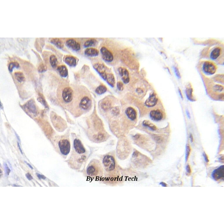 Anti-FoxO3A (phospho-S253) Antibody from Bioworld Technology (BS5019) - Antibodies.com