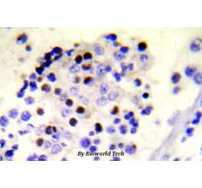 Anti-Histone H2A.X (phospho-S139) Antibody from Bioworld Technology (BS5023) - Antibodies.com