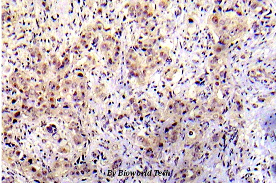 Anti-p53 (phospho-S20) Antibody from Bioworld Technology (BS5027) - Antibodies.com